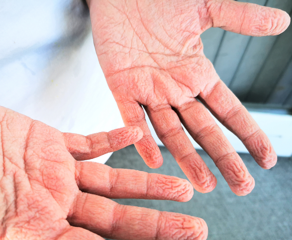 Close-up of wrinkled fingers after being soaked in water, highlighting the skin's natural reaction for improved grip.